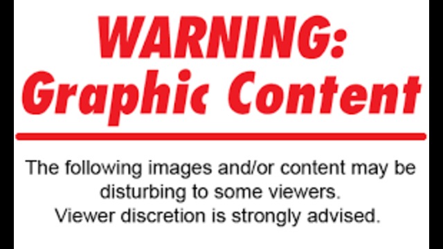 Remember when they hid the downvotes?